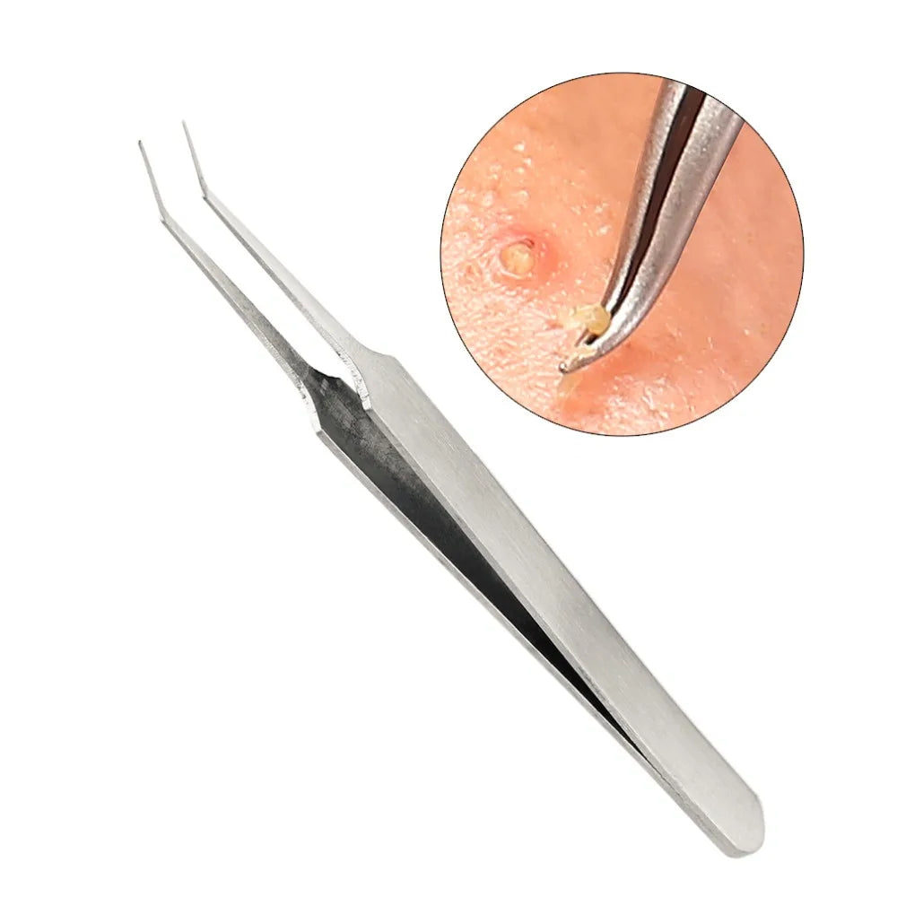 3 pcs/set Practical Acne Needle Tweezers Blackhead Pimples Removal -