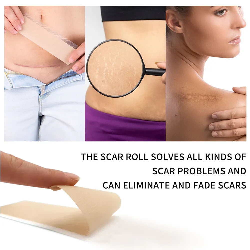 Efficient Surgery Scar Removal Silicone Gel Sheet Therapy Patch -