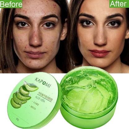 100% Pure Natural AloeVera Essence Skin Care-