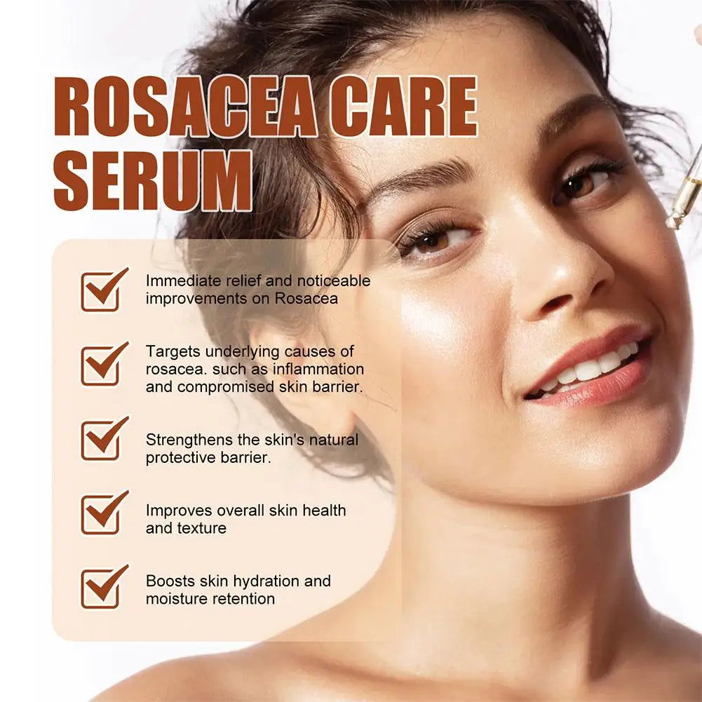 30ml Rosacea Cure Serum -