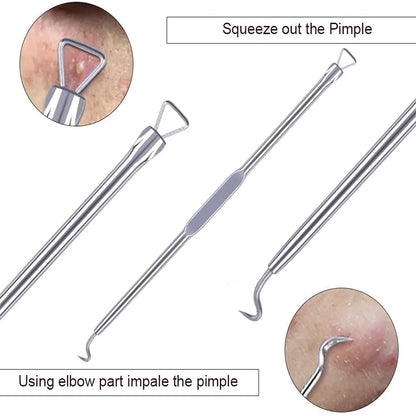 4pcs Acne Blackhead Removal Stainless steel -