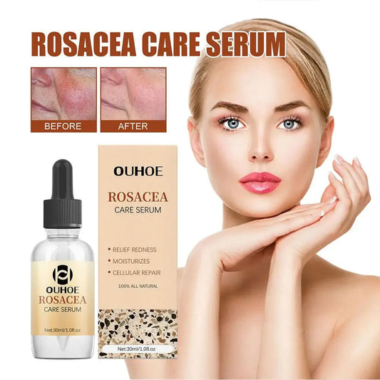 30ml Rosacea Cure Serum -