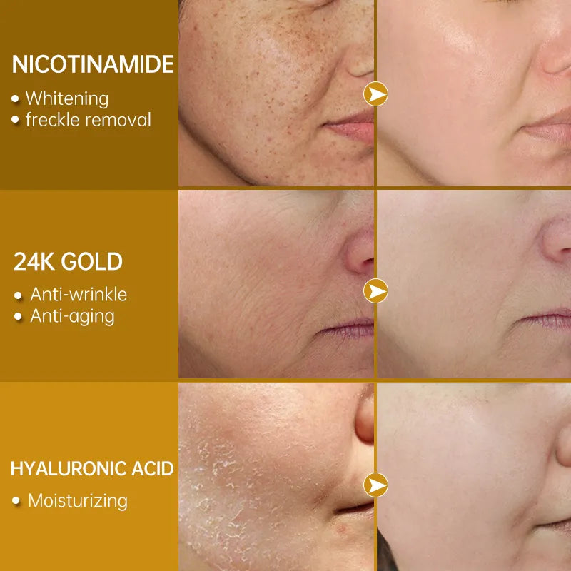 24K Gold Serum Hyaluronic Acid for Dark Spot Remover -